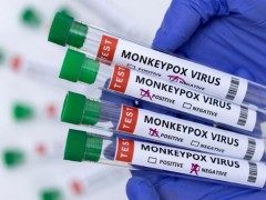 世界卫生组织针对猴痘发布最高级别公共卫生警报Monkeypox: WHO declares highest alert over outbreak